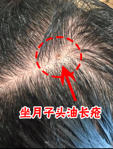 Scalpi Hair Refresher