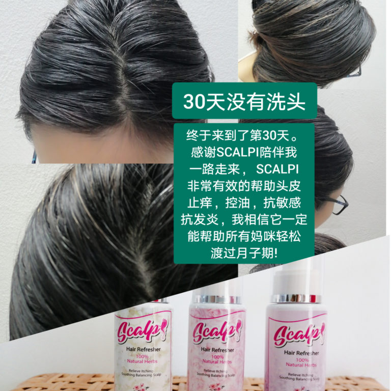 SCALPI 30天没洗头 完成坐月