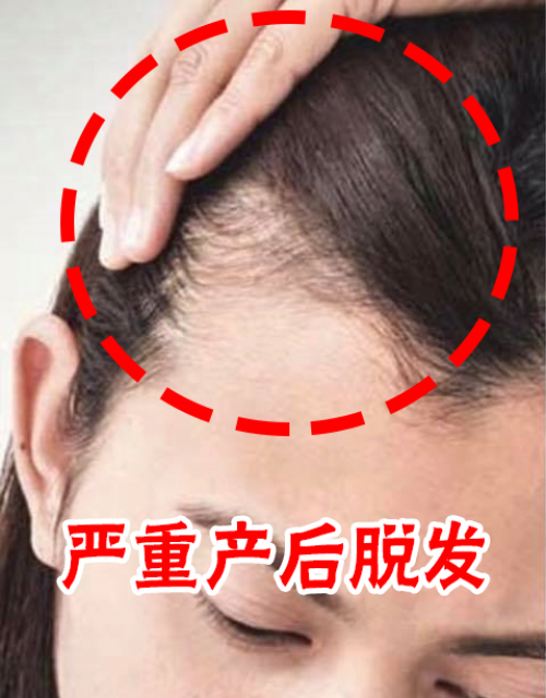 Scalpi Hair Refresher